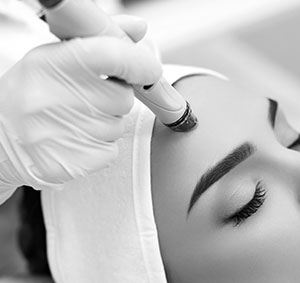 Microdermabrasion Therapy