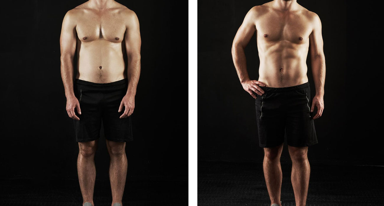 Six-pack Surgery Before and After