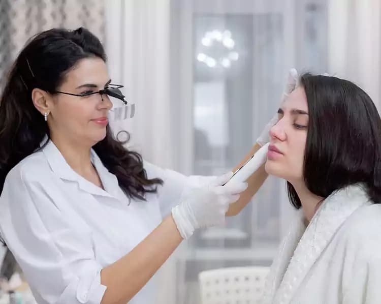 Sample image illustrating microneedling RF, after view