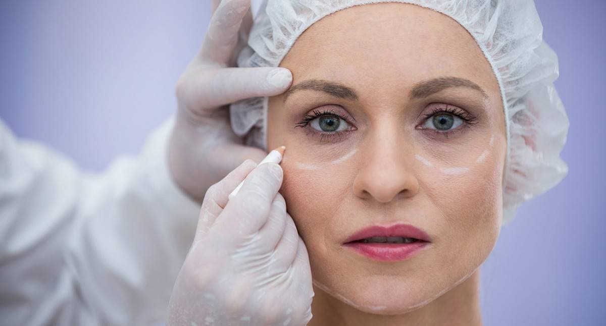 Surgeon marking a patient's lower eyelids before blepharoplasty
