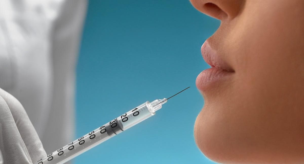 Lip filler injection being prepared for a patient's upper lip