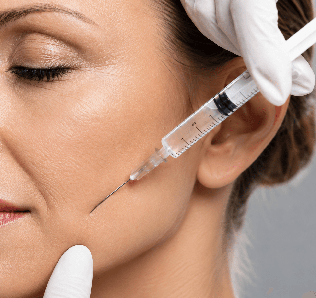 Sample image illustrating Botox treatment, after view