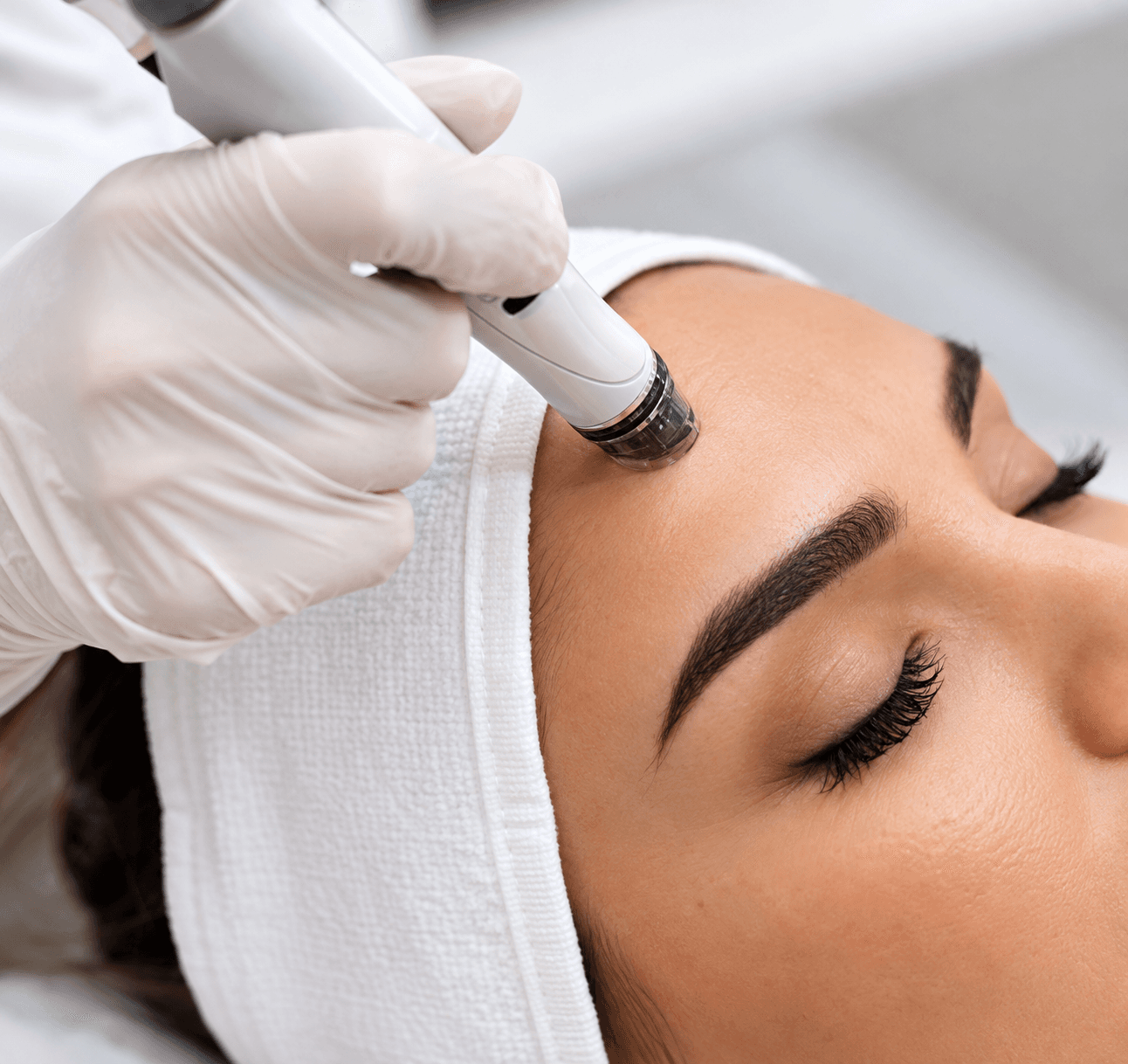Microdermabrasion handpiece being used on a patient's forehead