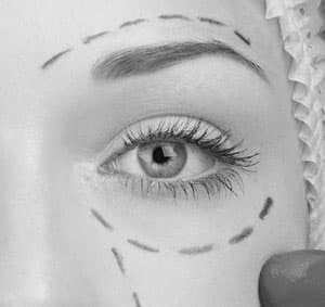 Close up eyelid surgical anatomy mapping
