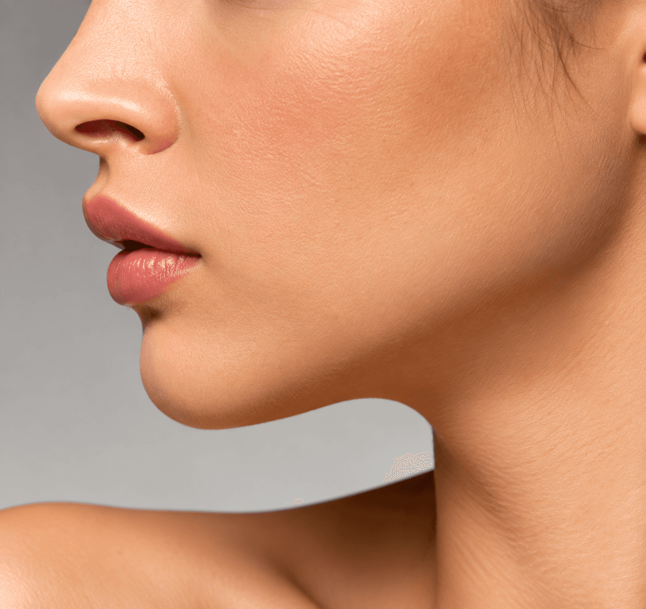 Sample image illustrating otoplasty, after view